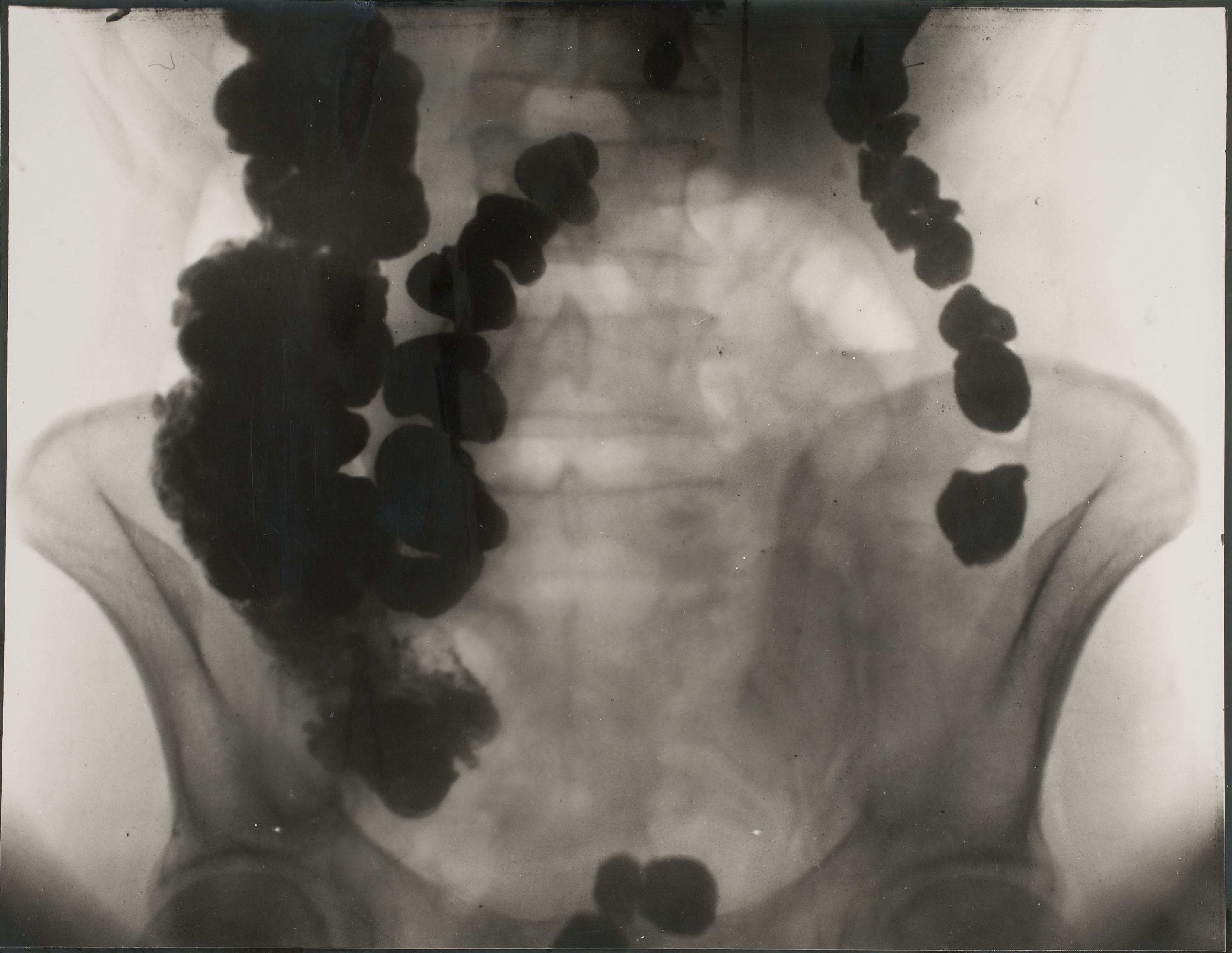 image for: Josep Maria Pujadas - Radiografia - 1928