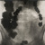 image for: Josep Maria Pujadas - Radiografia - 1928