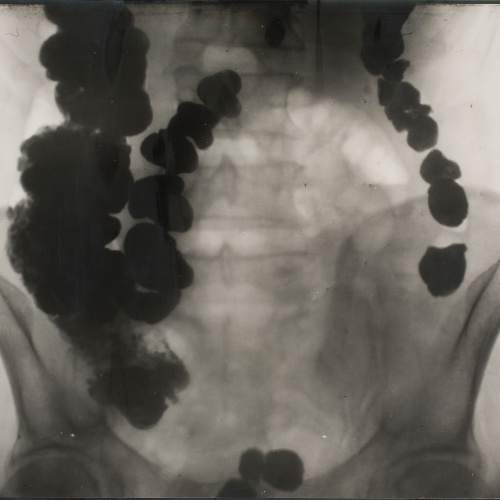 image for: Josep Maria Pujadas - Radiografia - 1928
